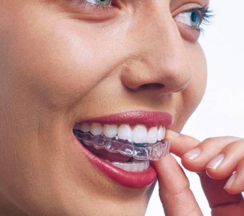 teeth straightening